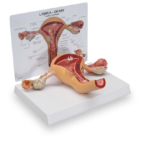 Picture of Uterus Model Galloway Plastics Full-Size 2 lbs.SB35435