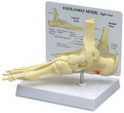 Picture of Foot/Ankle Plantar Fasciitis Model GPI Anatomicals Full Size70574
