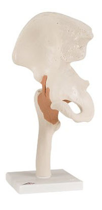 Picture of Functional Hip Joint Model 4 lbs.12-4510