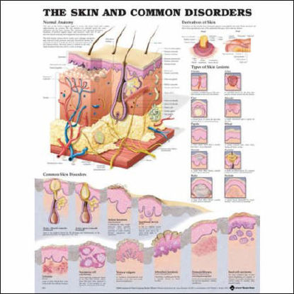 Picture of Anatomical Chart Skin and Common Disorders 20 X 26 Inch Heavy Paper Grommets Laminated1587796139