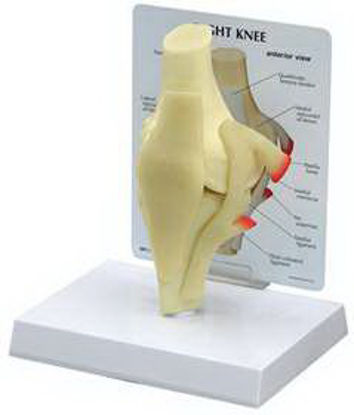 Picture of Basic Knee Model GPI Anatomicals Full Size70580