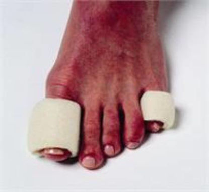 Picture of Toe Bandage Pedifix Pull On Toe8137-3