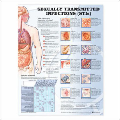 Picture of Anatomical Chart Sexually Transmitted Infections (STIS) 20 X 26 Inch Plastic Wall Mount Laminated9781587798504