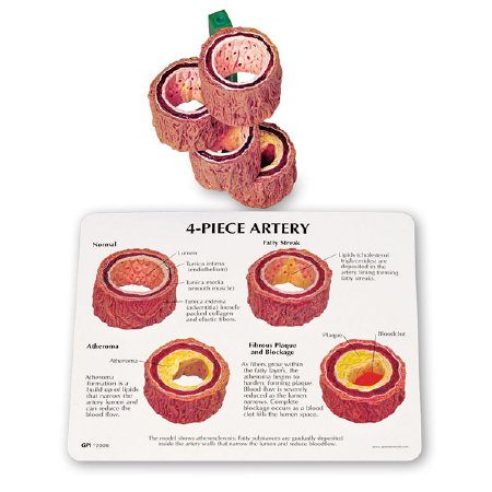 Picture of 4-Piece Artery ModelSB42963