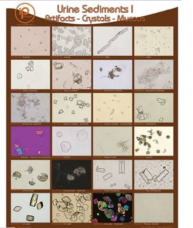 Picture of Poster and Binder Cards Urine Sediments 19 X 24 Inch1888