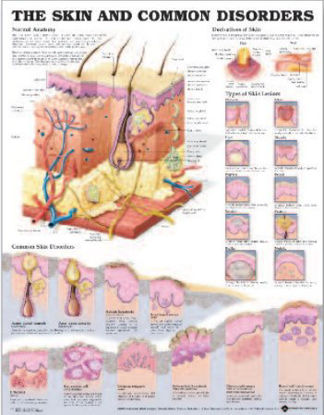 Picture of Anatomical Chart Skin Disorder 20 X 26 Inch Heavy Paper Grommets Laminated9781587796135