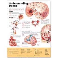 Picture of Anatomical Chart Understanding Stroke 20 X 26 Inch Heavy Paper Grommets Laminated9781587799884