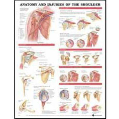 Picture of Anatomical Chart Anatomy and Injuries of the Shoulder 20 X 26 Inch Styrene Plastic9781587798092