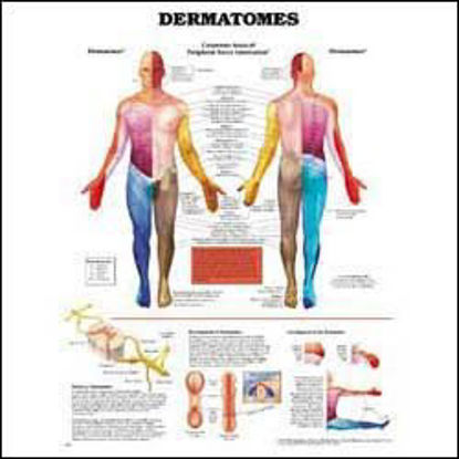 Picture of Anatomical Chart Dermatomes 20 X 26 Inch Heavy Paper Grommets Laminated9781587791116
