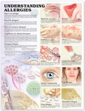 Picture of Anatomical Chart Allergies 20 X 26 Inch Heavy Paper Grommets Laminated9781587799402
