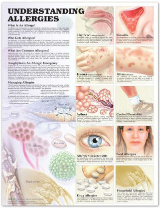 Picture of Anatomical Chart Allergies 20 X 26 Inch Heavy Paper Grommets Laminated9781587799402