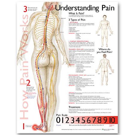Picture of Anatomical Chart Understanding Pain 20 X 26 Inch Plastic Wall Mount Laminated9781587799846