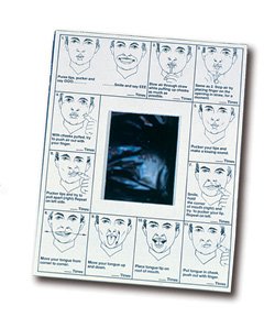 Picture of Oral Images™ Oral Image with Mirror 8-1/2 X 11 Inch Paper80610