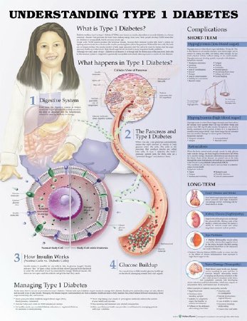 Picture of Anatomical Chart Type 1 Diabetes 3rd Edition 20 X 26 Inch Heavy Paper Grommets Laminated9781469894935