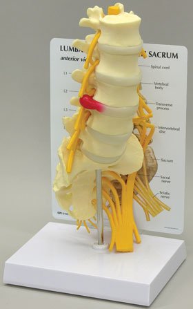 Picture of Lumbar with Sacrum Model70811
