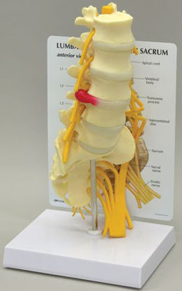 Picture of Lumbar with Sacrum Model70811