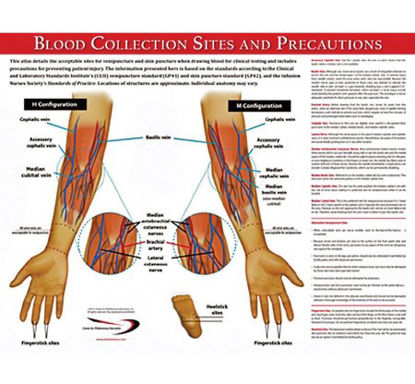 Picture of Anatomical Chart Blood Collection 17 X 22 Inch Laminated5488