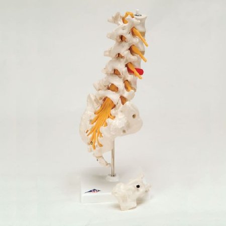 Picture of Prolapsed Lumbar Section Model FEI 13 Inch Height 1 lbs.928194