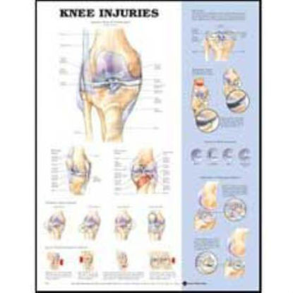 Picture of Anatomical Chart Knee 20 X 26 Inch Styrene Plastic Grommets9781587796968