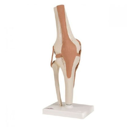 Picture of Anatomical Knee Model FEI8166