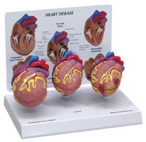 Picture of Heart Disease Model GPI Anatomicals470029-494