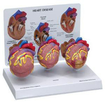 Picture of Heart Disease Model GPI Anatomicals470029-494