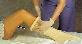 Picture of Stockinette Tubular Albahealth® 6 X 48 Inch Cotton Sterile7764