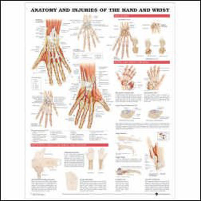 Picture of Anatomical Chart Injuries of the Hand and Wrist 20 X 26 Inch Heavy Paper Grommets Laminated9781587799143