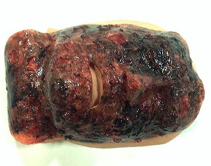 Picture of Moulage Xtreme Face Burn 3rd Degree Plastic800-002