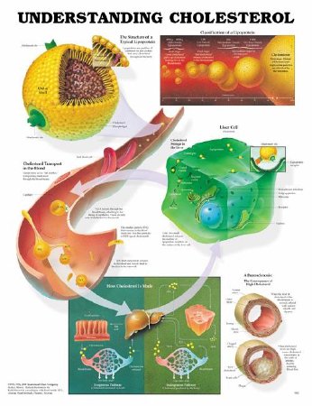 Picture of Anatomical Chart Understanding Cholesterol 20 X 26 Inch Plastic Wall Mount Laminated9781587793264