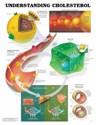Picture of Anatomical Chart Understanding Cholesterol 20 X 26 Inch Plastic Wall Mount Laminated9781587793264