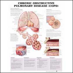 Picture of Anatomical Chart Chronic Obstructive Pulmonary Disease 20 X 26 Inch Plastic Wall Mount Laminated9780781782371