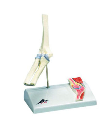Picture of Mini Elbow with Cross Section of Bone Model 2 lbs.12-4520