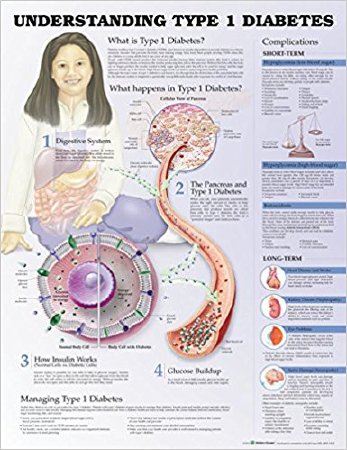 Picture of Anatomical Chart Type 1 Diabetes 20 X 26 Inch Heavy Paper Grommets Laminated9781469894942