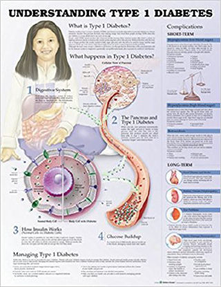 Picture of Anatomical Chart Type 1 Diabetes 20 X 26 Inch Heavy Paper Grommets Laminated9781469894942