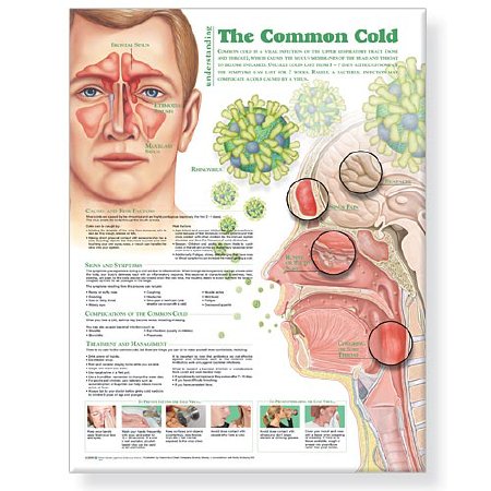 Picture of Anatomical Chart Understanding the Common Cold 20 X 26 Inch Heavy Paper Laminated9780781786317