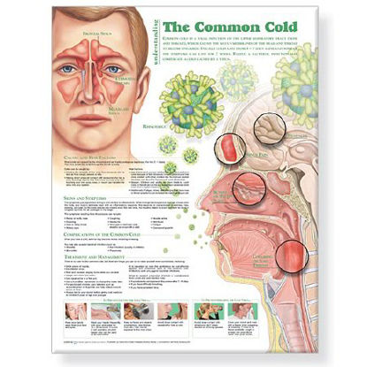 Picture of Anatomical Chart Understanding the Common Cold 20 X 26 Inch Heavy Paper Laminated9780781786317