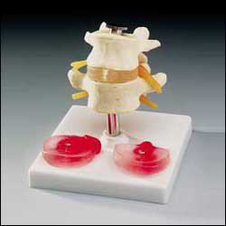 Picture of Lumbar Vertebrae Model PlasticCH76