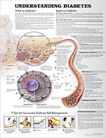 Picture of Anatomical Chart Understanding Diabetes 20 X 26 Inch Heavy Paper Grommets Laminated9781469894928