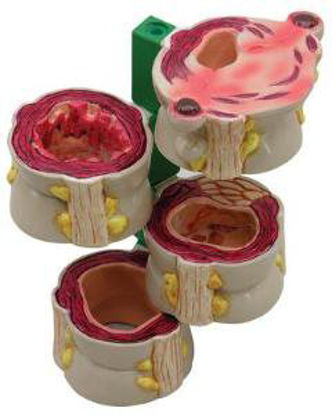 Picture of Colon Model GPI Anatomicals810976