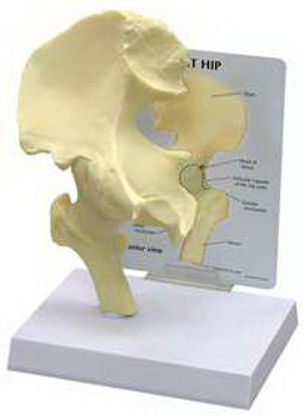 Picture of Basic Hip Model GPI Anatomicals Full Size70579