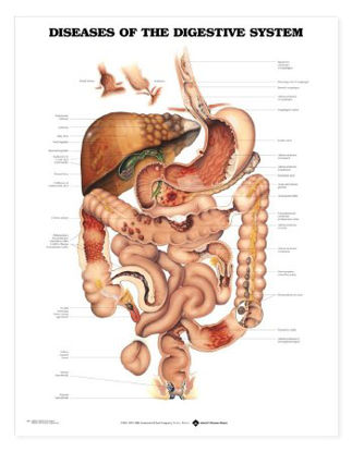 Picture of Anatomical Chart Digestive System 20 X 26 Inch Heavy Paper Grommets Laminated9781587792373