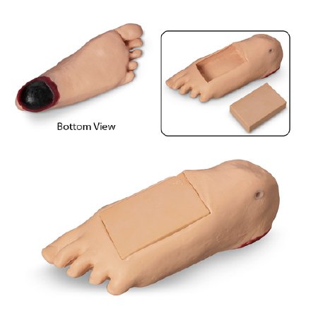 Picture of Optional Edema Foot with Deep tissue Injury Life/Form® Geri™LF04084