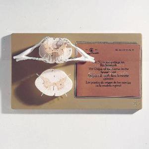 Picture of Spinal Cord with Nerve Branches Model Somso813021