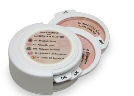 Picture of 5-Piece Hinged Skin Cancer Disk Set GPI Anatomicals®SB47381
