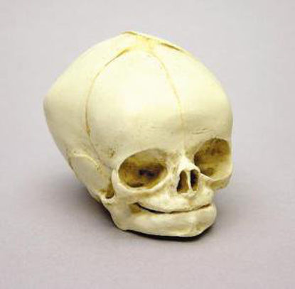 Picture of Fetal Skull Model Bone Clones823519