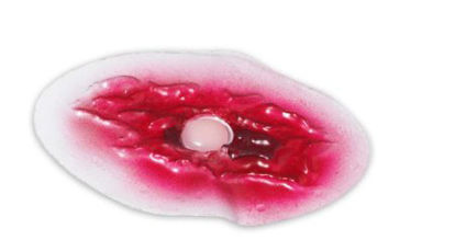 Picture of Wound - Bladder 0.25 lbs.800-833