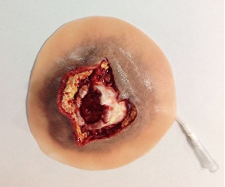 Picture of Moulage Open Humerus Fracture Plastic800-607