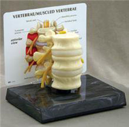 Picture of Basic Vertebrae Model70575