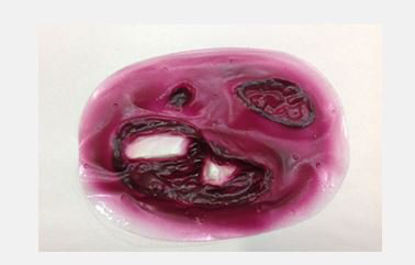 Picture of Tibia Stick-On800-906